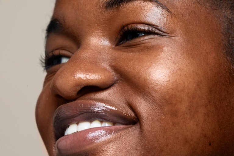 Lire la suite à propos de l’article Tache sur le visage : 5 facteurs que vous ignoriez surement